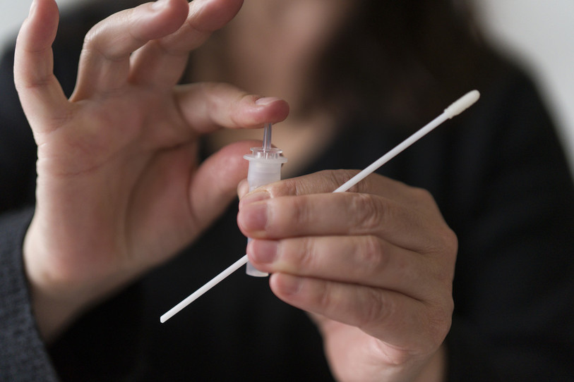 Il y a eu 3150 cas de Coronavirus en Suisse dans les dernières 24 heures. La taux de positivité s'élève à 15.68 %. (Photo : KEYSTONE / Gaetan Bally).