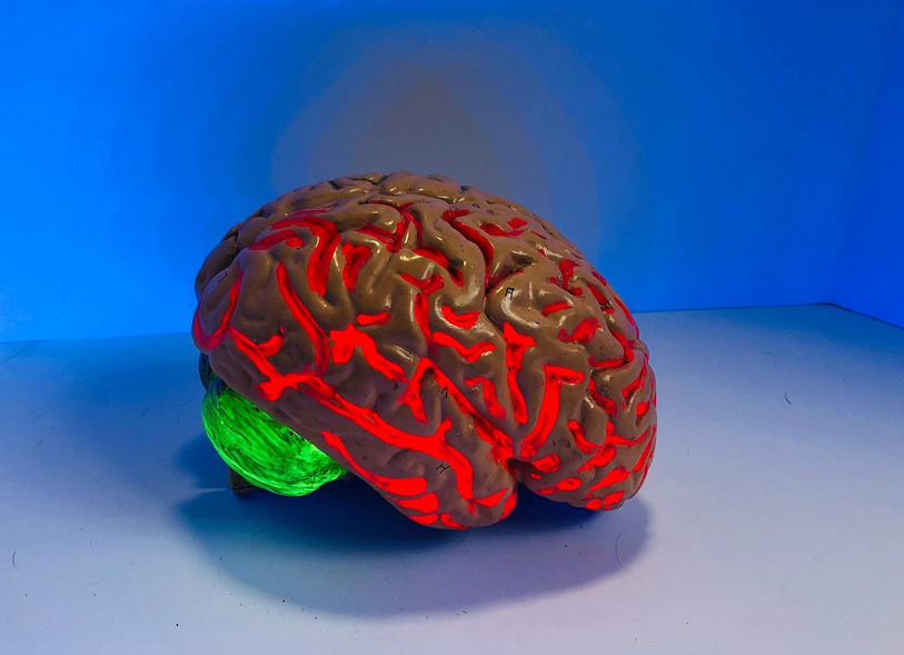 Un AVC, c'est l'arrêt de la circulation sanguine dans une partie du cerveau (photo d'illustration)