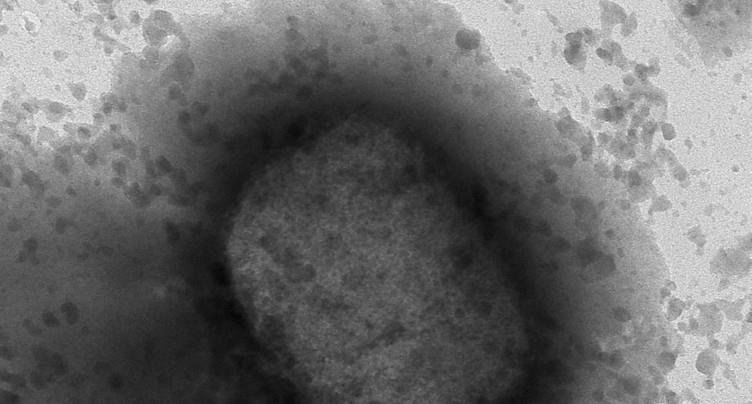 Troisième cas de variole du singe confirmé en Suisse