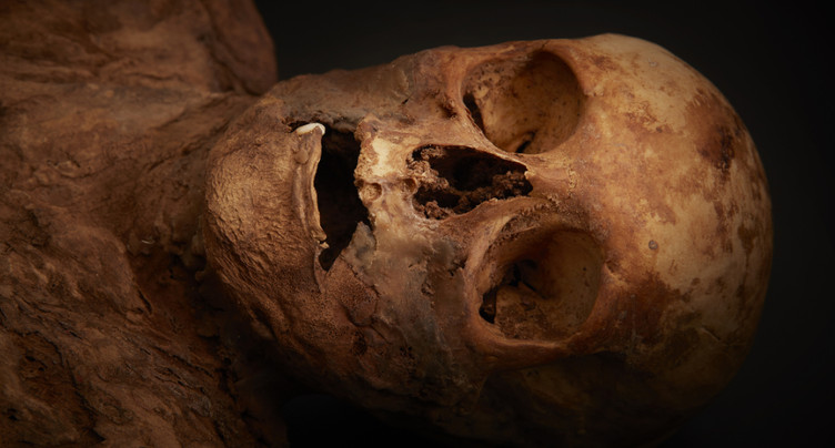 La momie bâloise est morte d'un traitement au mercure