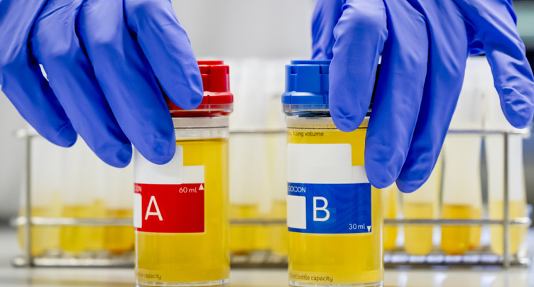 Au LAD d'Epalinges, plongée au coeur de l'analyse du dopage