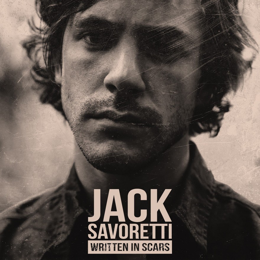 Jack Savoretti Cicatrise Grâce à La Chanson ! - RFJ Votre Radio Régionale